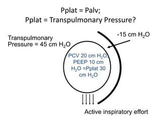 PCV 20 cm H2O,
PEEP 10 cm
H2O =Pplat 30
cm H2O
-15 cm H2O
Transpulmonary
Pressure = 45 cm H2O
Active inspiratory effort
Pplat = Palv;
Pplat = Transpulmonary Pressure?
 