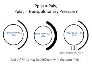 Pplat 30 cm H2O,
VCV
Pplat 30 cm H2O,
PCV
Active inspiratory effort
Pplat 30 cm H2O,
VCV
Pplat = Palv;
Pplat = Transpulmonary Pressure?
Risk of VILI may be different with the same Pplat
 
