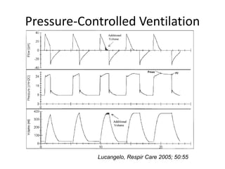 Pressure-Controlled Ventilation
Lucangelo, Respir Care 2005; 50:55
 