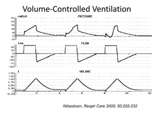 WK505 Effort
Nilsestuen, Respir Care 2005; 50:202-232
Volume-Controlled Ventilation
 