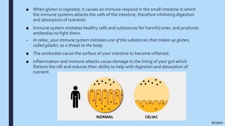 ■ When gluten is ingested, it causes an immune respond in the small intestine in which
the immune systems attacks the cells of the intestine, therefore inhibiting digestion
and absorption of nutrients
■ Immune system mistakes healthy cells and substances for harmful ones and produces
antibodies to fight them.
– In celiac, your immune system mistakes one of the substances that makes up gluten,
called gliadin, as a threat to the body.
■ The antibodies cause the surface of your intestine to become inflamed.
■ Inflammation and immune attacks cause damage to the lining of your gut which
flattens the villi and reduces their ability to help with digestion and absorption of
nutrient.
Kristin
 