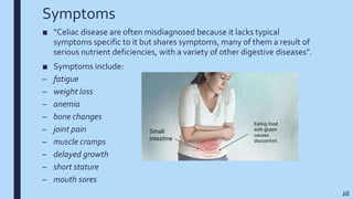 Symptoms
■ “Celiac disease are often misdiagnosed because it lacks typical
symptoms specific to it but shares symptoms, many of them a result of
serious nutrient deficiencies, with a variety of other digestive diseases”.
■ Symptoms include:
– fatigue
– weight loss
– anemia
– bone changes
– joint pain
– muscle cramps
– delayed growth
– short stature
– mouth sores
Jill
 