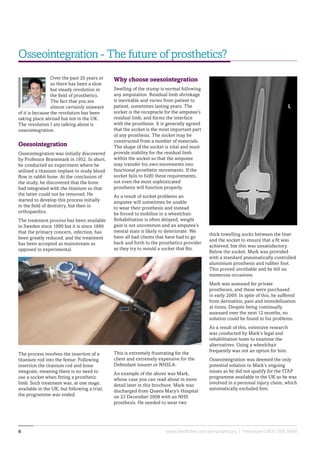 www.fieldfisher.com/personalinjury | Freephone 0800 358 38486
Why choose oeesointegration
Swelling of the stump is normal following
any amputation. Residual limb shrinkage
is inevitable and varies from patient to
patient, sometimes lasting years. The
socket is the receptacle for the amputee’s
residual limb, and forms the interface
with the prosthesis. It is generally agreed
that the socket is the most important part
of any prosthesis. The socket may be
constructed from a number of materials.
The shape of the socket is vital and must
provide stability for the residual limb
within the socket so that the amputee
may transfer his own movements into
functional prosthetic movements. If the
socket fails to fulfil these requirements,
not even the most sophisticated
prosthesis will function properly.
As a result of socket problems an
amputee will sometimes be unable
to wear their prosthesis and instead
be forced to mobilise in a wheelchair.
Rehabilitation is often delayed, weight
gain is not uncommon and an amputee’s
mental state is likely to deteriorate. We
have all had clients that have had to go
back and forth to the prosthetics provider
as they try to mould a socket that fits.
This is extremely frustrating for the
client and extremely expensive for the
Defendant insurer or NHSLA.
An example of the above was Mark,
whose case you can read about in more
detail later in this brochure. Mark was
discharged from Queen Mary’s Hospital
on 23 December 2008 with an NHS
prosthesis. He needed to wear two
thick towelling socks between the liner
and the socket to ensure that a fit was
achieved, but this was unsatisfactory.
Below the socket, Mark was provided
with a standard pneumatically controlled
aluminium prosthesis and rubber foot.
This proved unreliable and he fell on
numerous occasions.
Mark was assessed for private
prostheses, and these were purchased
in early 2009. In spite of this, he suffered
from dermatitis, pain and immobilisation
at times. Despite being continually
assessed over the next 12 months, no
solution could be found to his problems.
As a result of this, extensive research
was conducted by Mark’s legal and
rehabilitation team to examine the
alternatives. Using a wheelchair
frequently was not an option for him.
Osseointegration was deemed the only
potential solution to Mark’s ongoing
issues as he did not qualify for the ITAP
programme available in the UK as he was
involved in a personal injury claim, which
automatically excluded him.
Osseointegration - The future of prosthetics?
Over the past 20 years or
so there has been a slow
but steady revolution in
the field of prosthetics.
The fact that you are
almost certainly unaware
of it is because the revolution has been
taking place abroad but not in the UK.
The revolution I am talking about is
osseointegration.
Oeesointegration
Osseointegration was initially discovered
by Professor Branemark in 1952. In short,
he conducted an experiment where he
utilised a titanium implant to study blood
flow in rabbit bone. At the conclusion of
the study, he discovered that the bone
had integrated with the titanium so that
the latter could not be removed. He
started to develop this process initially
in the field of dentistry, but then in
orthopaedics.
The treatment process has been available
in Sweden since 1990 but it is since 1999
that the primary concern, infection, has
been greatly reduced, and the treatment
has been accepted as mainstream as
opposed to experimental.
The process involves the insertion of a
titanium rod into the femur. Following
insertion the titanium rod and bone
integrate, meaning there is no need to
use a socket when fitting a prosthetic
limb. Such treatment was, at one stage,
available in the UK, but following a trial,
the programme was ended.
 