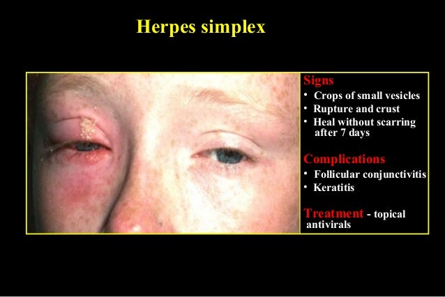 03 Diffuse Eyelid Diseases