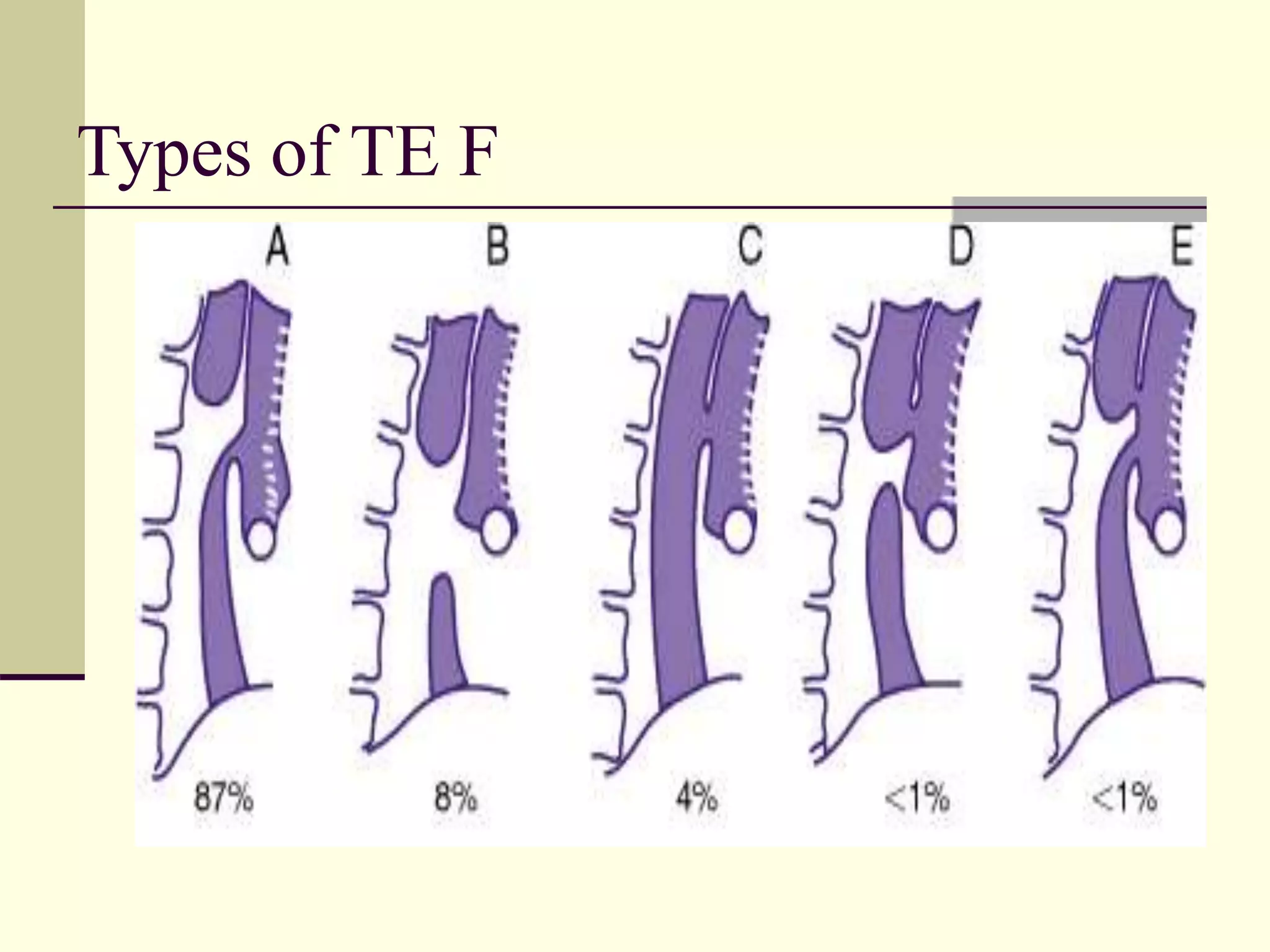 Types of TE F
 