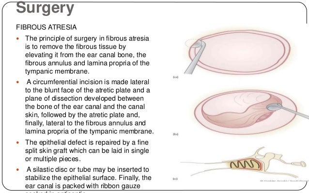 External auditory canal anatomy pathologies & management