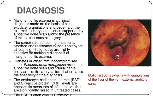 External auditory canal anatomy pathologies & management