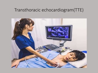 Tte Monitoring how to read echocardiography of heart.pptx