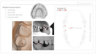 Re: 
Li: 
Protrusionsbiss, HCN 
IKP = RKP/ Frühkontakte 
Modell examination 
manually 
overview 
manually dynamic 
instrumental 
static 
⎪EXAMINATION 
30 
35  