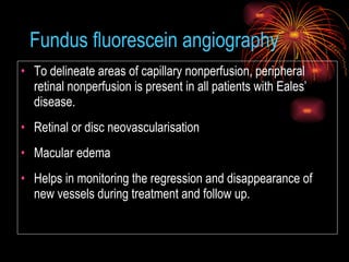 Fundus fluorescein angiography To delineate areas of capillary nonperfusion, peripheral retinal nonperfusion is present in all patients with Eales’ disease. Retinal or disc neovascularisation Macular edema  Helps in monitoring the regression and disappearance of new vessels during treatment and follow up. 