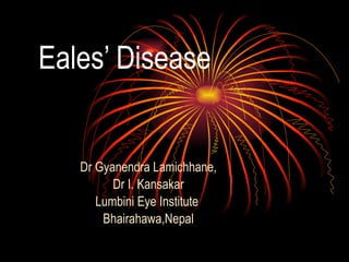 Eales’ Disease Dr Gyanendra Lamichhane, Dr I. Kansakar Lumbini Eye Institute  Bhairahawa,Nepal 