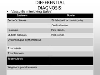DIFFERENTIAL
DIAGNOSIS:
• Vasculitis mimicking Eales’
diseaseSystemic Ocular
Behcet’s disease Birdshot retinochoroidopathy
Coat’s disease
Leukemia Pars planitis
Multiple sclerosis Viral retinitis
Systemic lupus erythematosus
Toxocariasis
Toxoplasmosis
Tuberculosis
Wegener’s granulomatosis
 