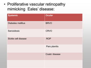 • Proliferative vascular retinopathy
mimicking Eales’ disease:
Systemic Ocular
Diabetes mellitus BRVO
Sarcoidosis CRVO
Sickle cell disease ROP
Pars planitis
Coats’ disease
 