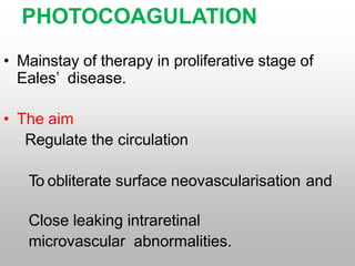 PHOTOCOAGULATION
• Mainstay of therapy in proliferative stage of
Eales’ disease.
• The aim
Regulate the circulation
To obliterate surface neovascularisation and
Close leaking intraretinal
microvascular abnormalities.
 