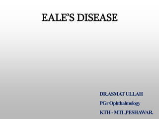 EALE’S DISEASE
DR.ASMATULLAH
PGrOphthalmology
KTH-MTI,PESHAWAR.
 