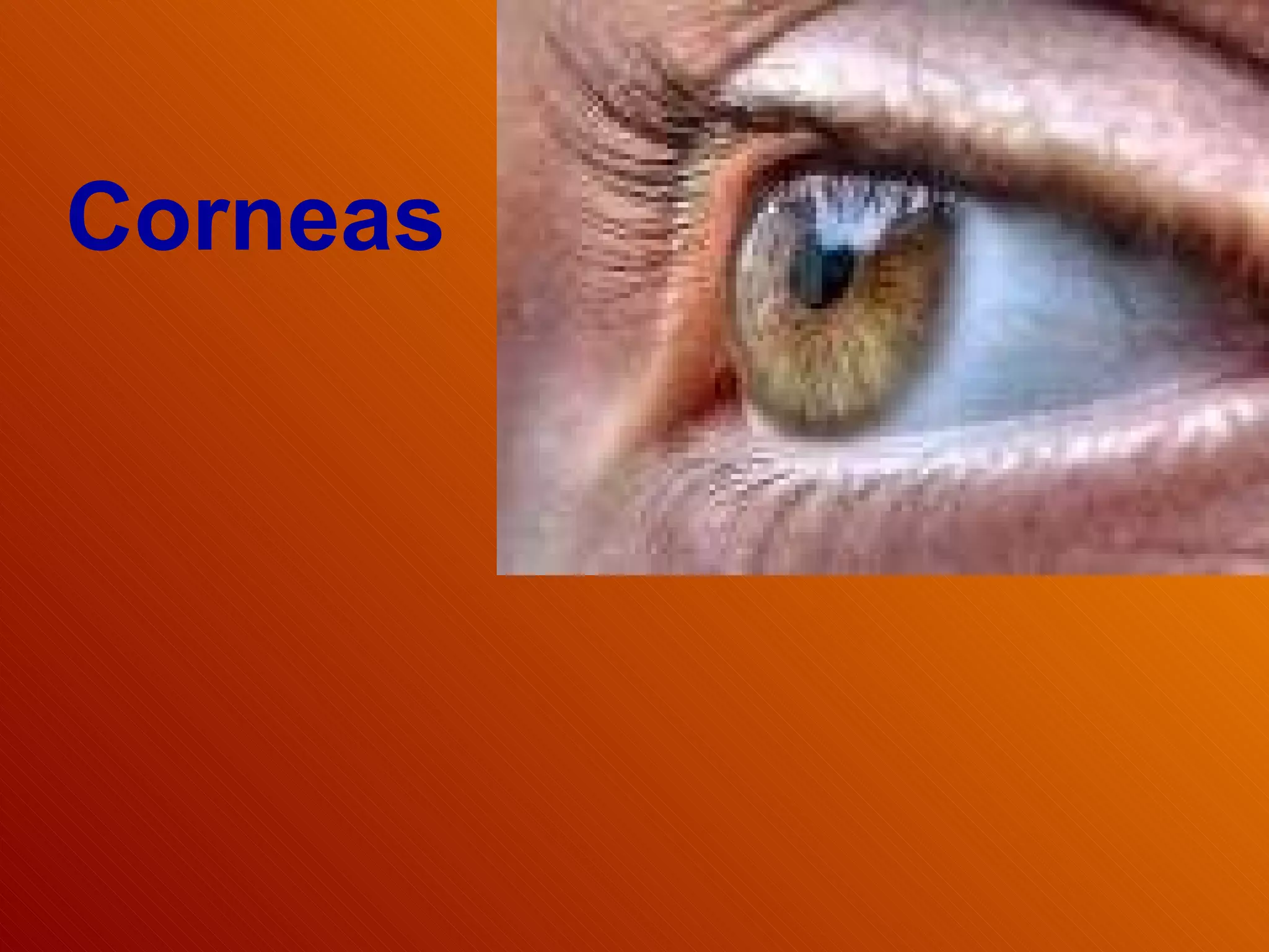 Corneas 