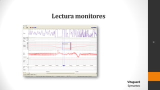 Lectura monitores
Vitaguard
Symantec
31
 