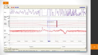 1
33
Artefacto. Falsas alarmas.
Reales 7,3%.
 