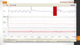 2 Lecturas monitores
34
 