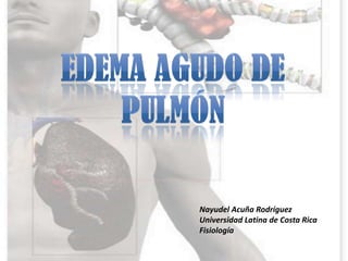 Nayudel Acuña Rodríguez
Universidad Latina de Costa Rica
Fisiología
 