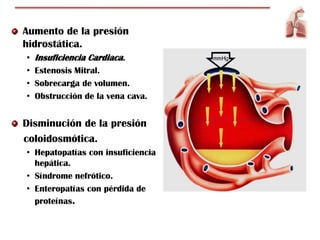 Aumento de la presión
hidrostática.
•   Insuficiencia Cardiaca.
•   Estenosis Mitral.
•   Sobrecarga de volumen.
•   Obstrucción de la vena cava.


Disminución de la presión
coloidosmótica.
• Hepatopatías con insuficiencia
  hepática.
• Síndrome nefrótico.
• Enteropatías con pérdida de
  proteínas.
 