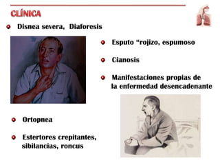 Disnea severa, Diaforesis

                            Esputo “rojizo, espumoso

                            Cianosis

                            Manifestaciones propias de
                            la enfermedad desencadenante



 Ortopnea

 Estertores crepitantes,
 sibilancias, roncus
 