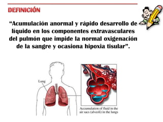 “Acumulación anormal y rápido desarrollo de
 líquido en los componentes extravasculares
del pulmón que impide la normal oxigenación
   de la sangre y ocasiona hipoxia tisular”.
 