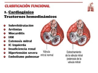1. Cardiogénico
Trastornos hemodinámicos

  Sobrehidratación
  Arritmias
  Miocarditis
  IAM
  Estenosis mitral
  IC Izquierda
  Insuficiencia renal
  Hipertensión severa
  Embolismo pulmonar
 