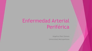 Enfermedad Arterial
Periférica
Angelica Diaz Zamora
Universidad Metropolitana
 