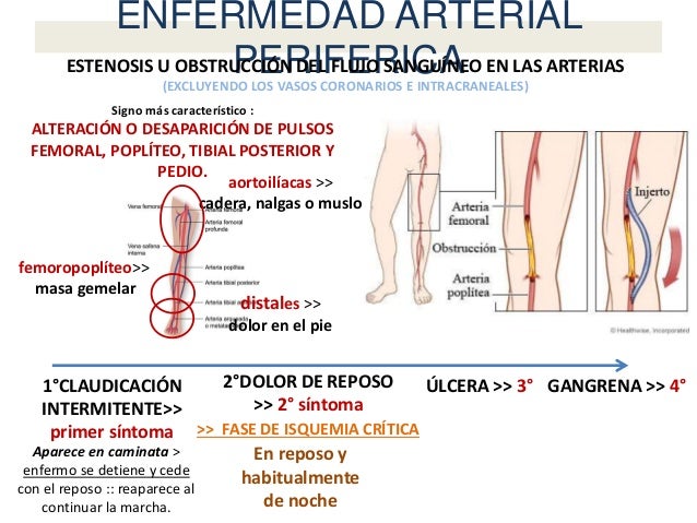 Enfermedad Arterial Periferica