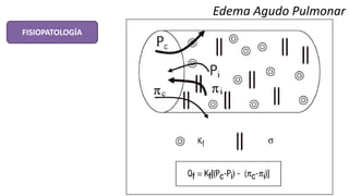 Edema Agudo Pulmonar
FISIOPATOLOGÍA
 
