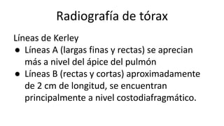 Radiografía de tórax
Líneas de Kerley
● Líneas A (largas finas y rectas) se aprecian
más a nivel del ápice del pulmón
● Líneas B (rectas y cortas) aproximadamente
de 2 cm de longitud, se encuentran
principalmente a nivel costodiafragmático.
 