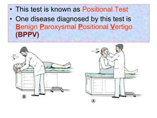 • This test is known as Positional Test
• One disease diagnosed by this test is
Benign Paroxysmal Positional Vertigo
(BPPV)
 