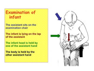 Examination of
infant
The assistant sits on the
examination chair
The infant is lying on the lap
of the assistant
The infant head is held by
one of the assistant hand
The body is held by the
other assistant hand
 