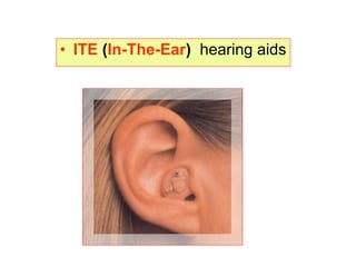 • ITE (In-The-Ear) hearing aids
 