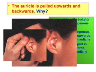 • The auricle is pulled upwards and
backwards, Why?
Answer: this will straighten
the outer cartilagenous
part because:
• The outer cartilagenous
part is directed upwards,
backwards and medially
• The inner bony part is
directed downwards,
forwards and medially
 