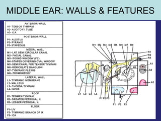 32
MIDDLE EAR: WALLS & FEATURES
 