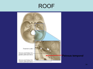 34
Petrous temporal
ROOF
 