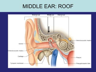 35
MIDDLE EAR: ROOF
 