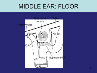 37
Epitympanic
recess
Aditus
Auditory tube
ICA
Sup bulb of IJV
VII CN
MIDDLE EAR: FLOOR
 