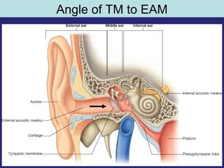 11
Angle of TM to EAM
 