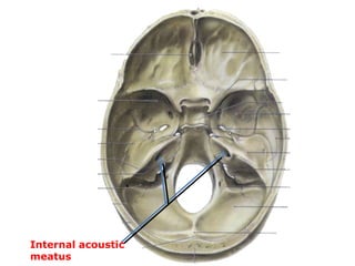 Internal acoustic
meatus
.
 