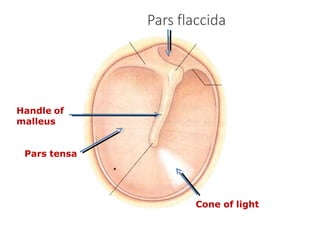 Pars flaccida
Handle of
malleus
Pars tensa
.
Cone of light
 