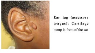 Ear Collection Bump EAR ASSESSMENT | PDF