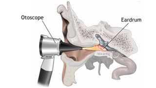 EAR ASSESSMENT | PDF