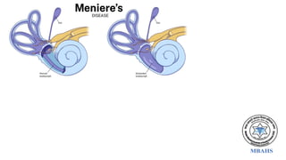 Ear Anatomy - External ear, Middle ear, Inner ear