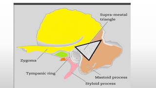 Pyramidal Prominence EAR-ANATOMY.pdf