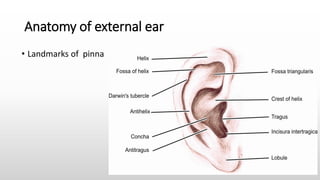 Anatomy of external ear
• Landmarks of pinna
 
