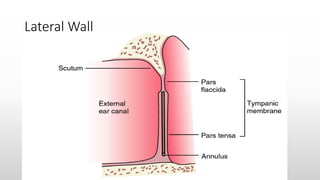 Lateral Wall
 