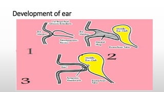 Development of ear
 